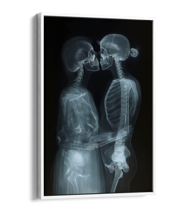 Float Effect Canvas Art - X-Ray Couple Kissing Bedroom Wall Art Print