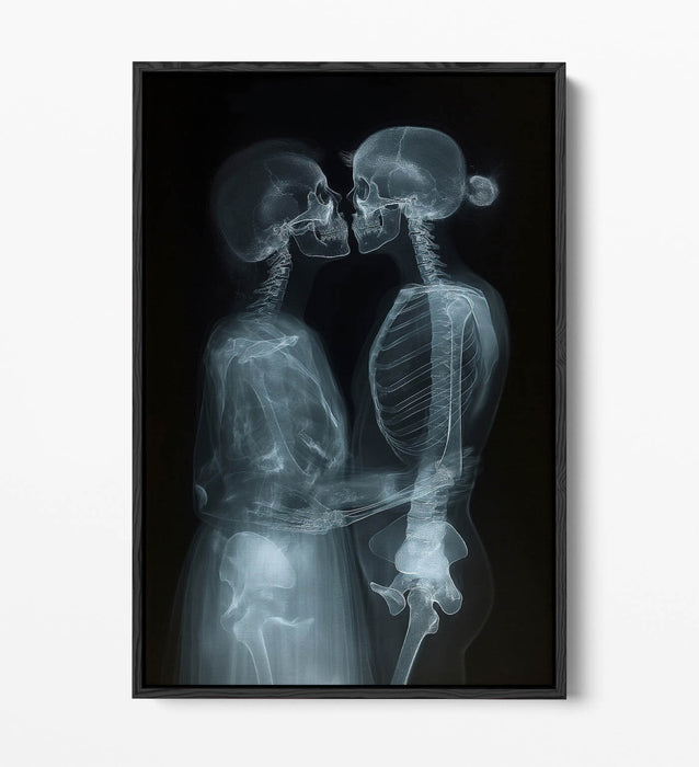 Float Effect Canvas Art - X-Ray Couple Kissing Bedroom Wall Art Print